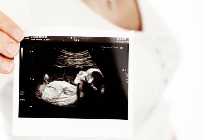 težina i dužina fetusa po nedeljama trudnoce