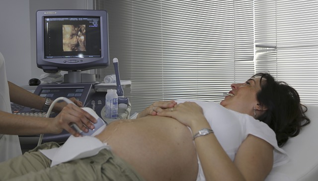 mere fetusa na ultrazvuku 